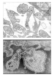 Figure 2. Illustration details of two different mumps virus by electron microscopy (EM) in vero cells
