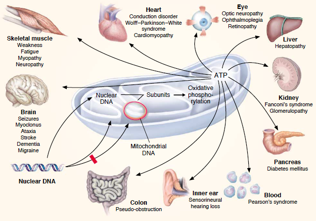 Image:Mitodisorders.png