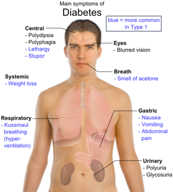 The Main Symptoms of Diabetes