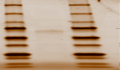 Figure 1: SDS Page Gel of 2QRU Purified Protein from Elution Sample in columns 13, 14, 15 showing 33.8 kda