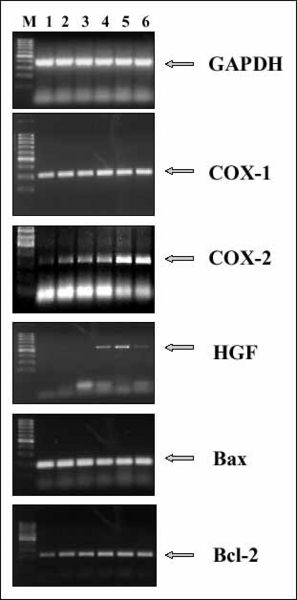 Image:RT-PCR GAPDH.jpg