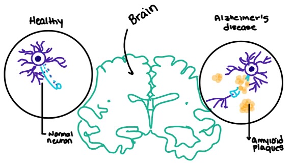 Image:Amylin brain.jpeg