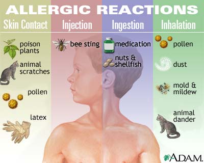 Image:Allergic_reactions.jpg