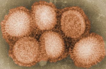 Picture of the H1N1 Influenza Virus