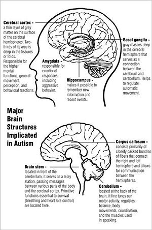 Description of an Autistic Brain