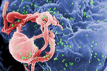 HIV-1 virus budding from an infected lymphocyte.