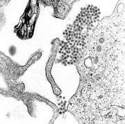A TEM micrograph showing dengue virus virions (the cluster of dark dots near the center)